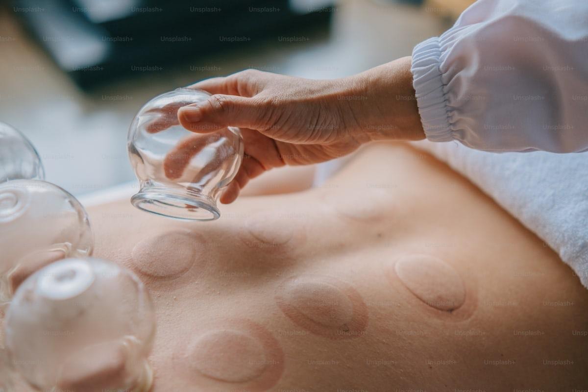 Cupping Therapy Ayurvedic therapy at SUKHAYUKTI Centre Mohali